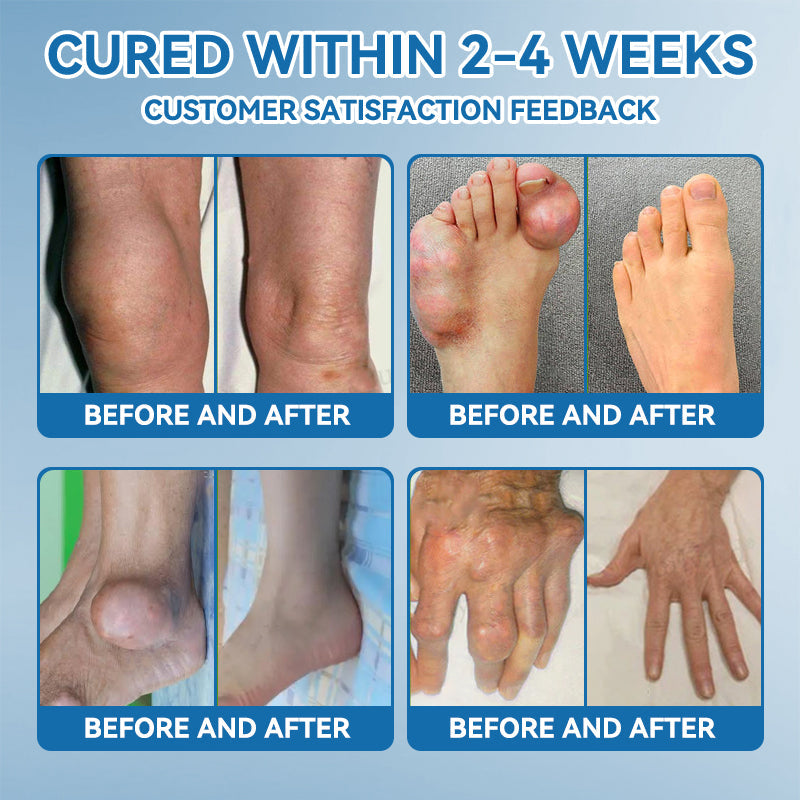 𝒁𝐯𝐨𝐞𝐯𝐨® 𝑩𝐏𝐂-𝟏𝟓𝟕 𝐉𝐨𝐢𝐧𝐭 𝐇𝐞𝐚𝐥𝐢𝐧𝐠 𝐂𝐫𝐞𝐚𝐦🦴 Relief for Arthritis, Neuropathy, Rheumatism & Sports Injuries & 𝐌𝐨𝐫𝐞