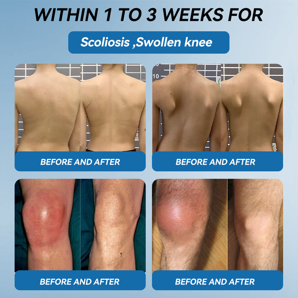 𝒁𝐯𝐨𝐞𝐯𝐨® 𝑩𝐏𝐂-𝟏𝟓𝟕 𝐉𝐨𝐢𝐧𝐭 𝐇𝐞𝐚𝐥𝐢𝐧𝐠 𝐂𝐫𝐞𝐚𝐦🦴 Relief for Arthritis, Neuropathy, Rheumatism & Sports Injuries & 𝐌𝐨𝐫𝐞