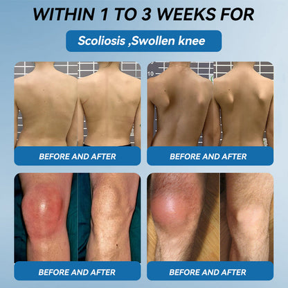 𝒁𝐯𝐨𝐞𝐯𝐨® 𝑩𝐏𝐂-𝟏𝟓𝟕 𝐉𝐨𝐢𝐧𝐭 𝐇𝐞𝐚𝐥𝐢𝐧𝐠 𝐂𝐫𝐞𝐚𝐦🦴 Relief for Arthritis, Neuropathy, Rheumatism & Sports Injuries & 𝐌𝐨𝐫𝐞