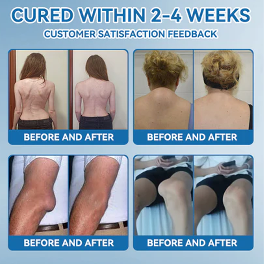 ✅ Zvoe𝐯𝗼® 𝗕𝖯𝖢-𝟏𝟓𝟕 Joint Healing Cream (🏅The Ultimate Solution for Muscle Aches, Arthritis, Joint Pain, Nerve Pain, Inflammation, and Stiffness)