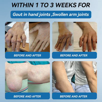𝒁𝐯𝐨𝐞𝐯𝐨® 𝑩𝐏𝐂-𝟏𝟓𝟕 𝐉𝐨𝐢𝐧𝐭 𝐇𝐞𝐚𝐥𝐢𝐧𝐠 𝐂𝐫𝐞𝐚𝐦🦴 Relief for Arthritis, Neuropathy, Rheumatism & Sports Injuries & 𝐌𝐨𝐫𝐞