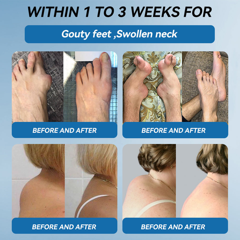 𝒁𝐯𝐨𝐞𝐯𝐨® 𝑩𝐏𝐂-𝟏𝟓𝟕 𝐉𝐨𝐢𝐧𝐭 𝐇𝐞𝐚𝐥𝐢𝐧𝐠 𝐂𝐫𝐞𝐚𝐦🦴 Relief for Arthritis, Neuropathy, Rheumatism & Sports Injuries & 𝐌𝐨𝐫𝐞