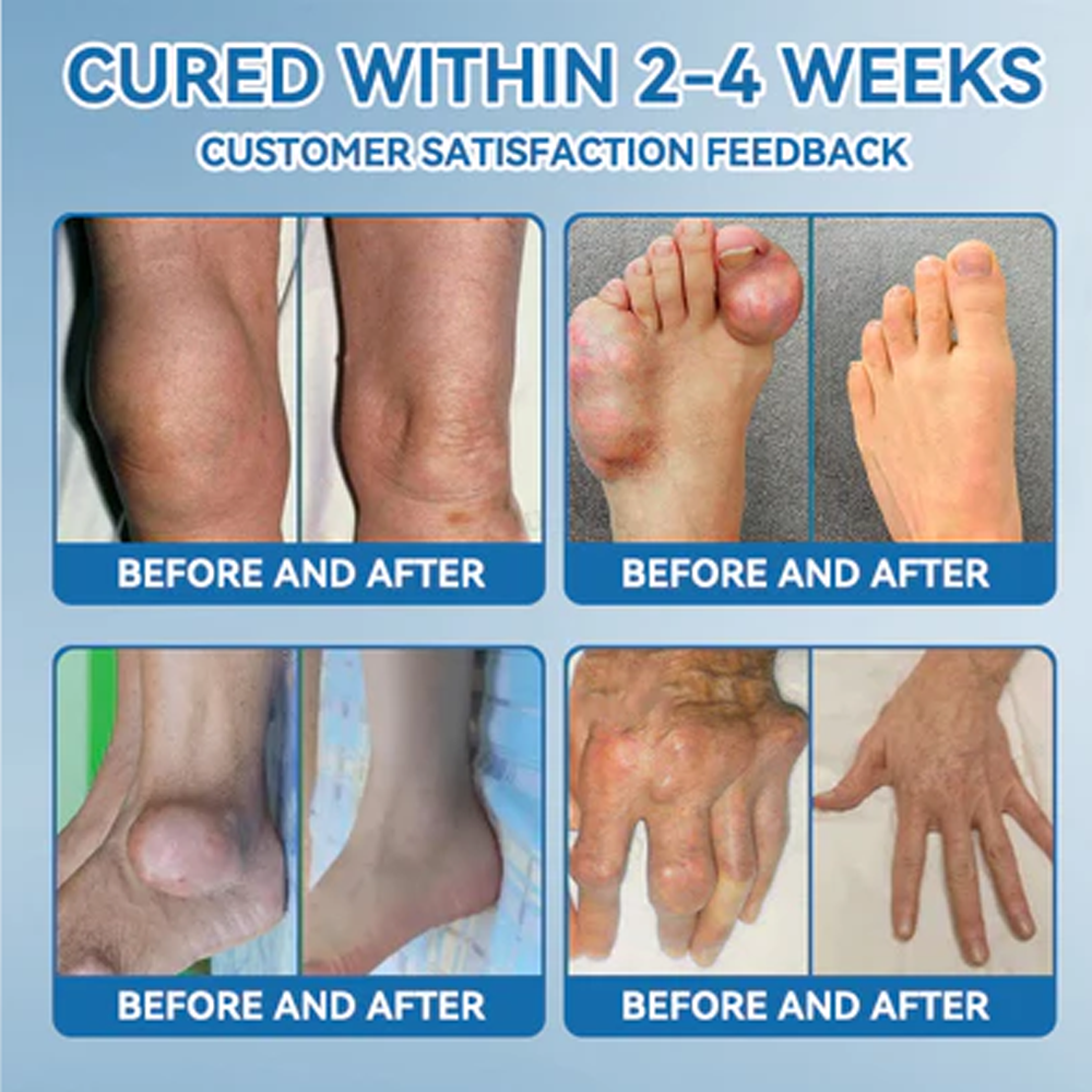 ✅ Zvoe𝐯𝗼® 𝗕𝖯𝖢-𝟏𝟓𝟕 Joint Healing Cream (🏅The Ultimate Solution for Muscle Aches, Arthritis, Joint Pain, Nerve Pain, Inflammation, and Stiffness)