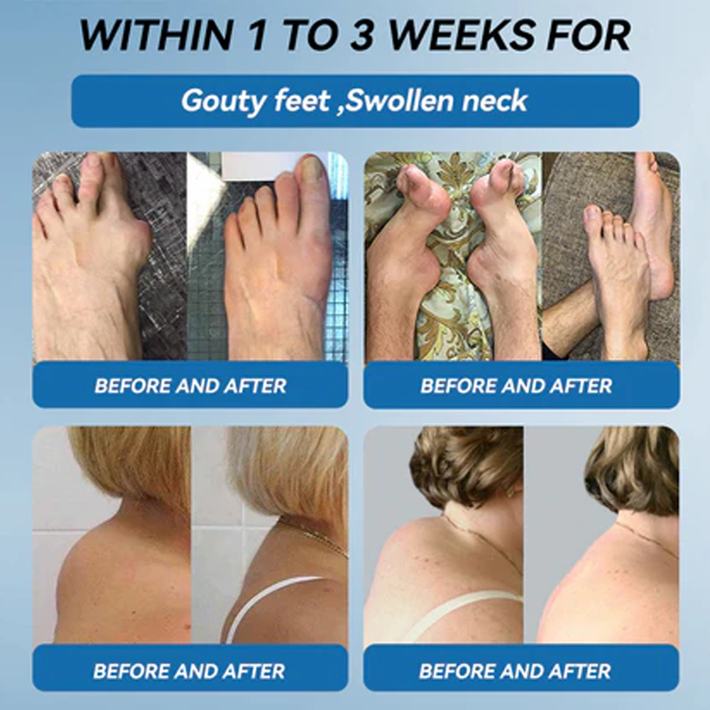 ✅ Zvoe𝐯𝗼® 𝗕𝖯𝖢-𝟏𝟓𝟕 Joint Healing Cream (🏅The Ultimate Solution for Muscle Aches, Arthritis, Joint Pain, Nerve Pain, Inflammation, and Stiffness)