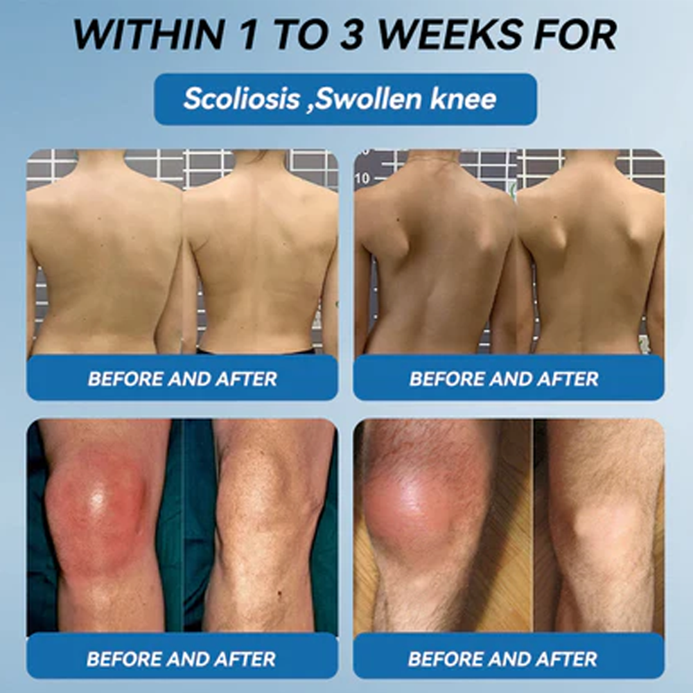 ✅ Zvoe𝐯𝗼® 𝗕𝖯𝖢-𝟏𝟓𝟕 Joint Healing Cream (🏅The Ultimate Solution for Muscle Aches, Arthritis, Joint Pain, Nerve Pain, Inflammation, and Stiffness)
