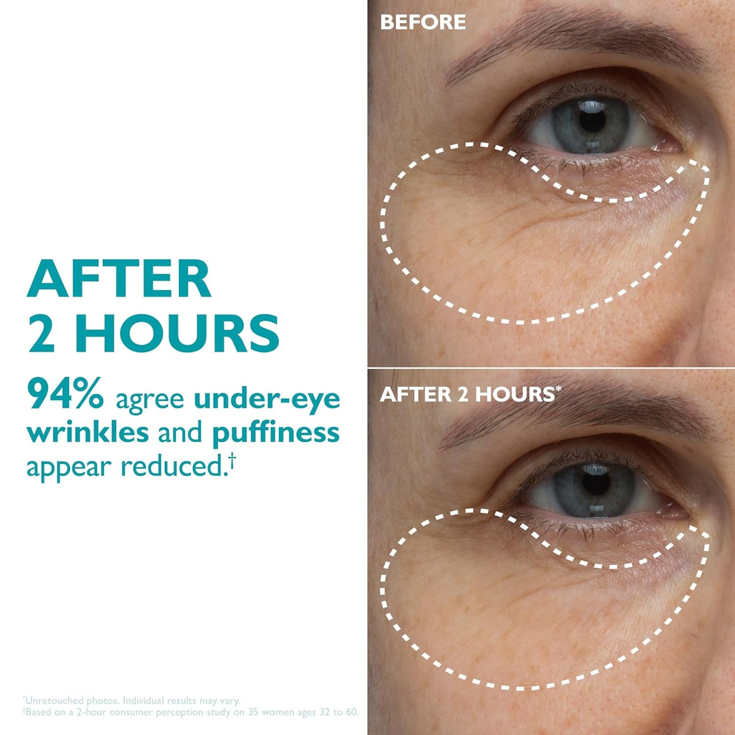 Elyviana Hydro-Gel Face & Eye Patches | Anti-Wrinkle & Hydrating