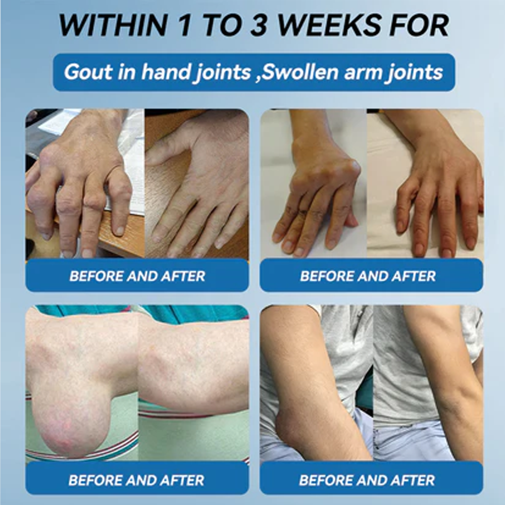 ✅ Zvoe𝐯𝗼® 𝗕𝖯𝖢-𝟏𝟓𝟕 Joint Healing Cream (🏅The Ultimate Solution for Muscle Aches, Arthritis, Joint Pain, Nerve Pain, Inflammation, and Stiffness)