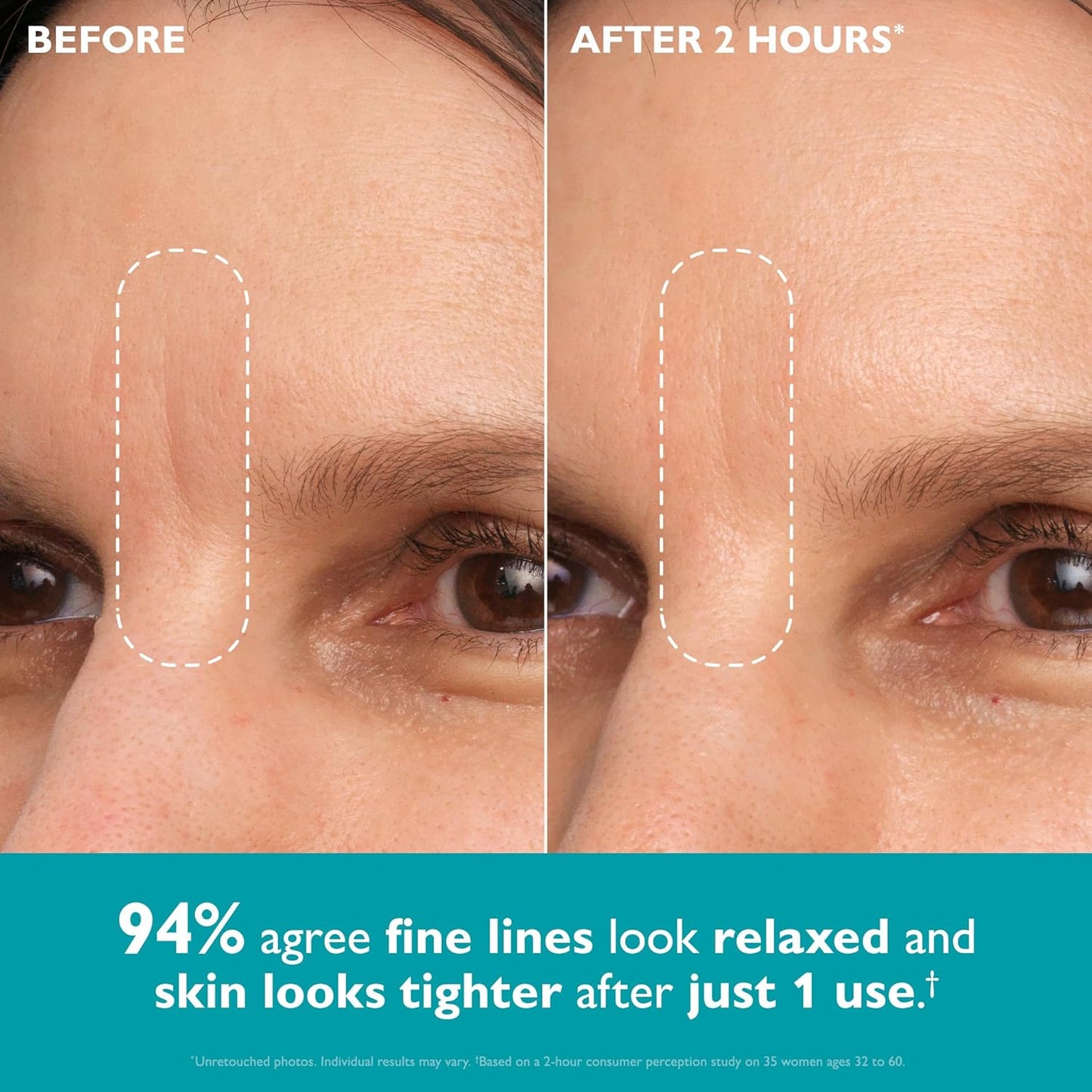 Elyviana Hydro-Gel Face & Eye Patches | Anti-Wrinkle & Hydrating